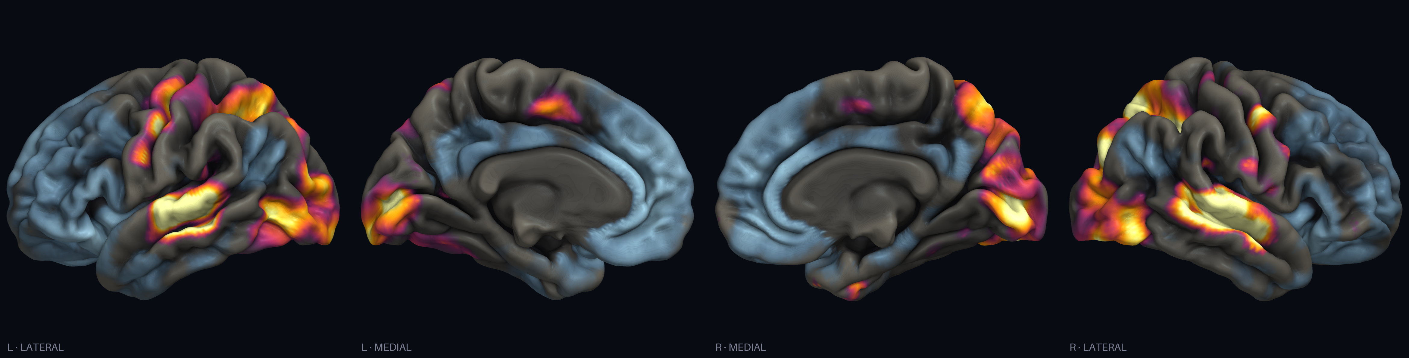 Predicted cortical activation — whole-ad average